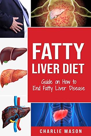 Download Fatty Liver Diet: Guide on How to End Fatty Liver Disease Fatty Liver Diet Books: Fatty Liver Diet (fatty liver diet for fatty liver Book 1) - Charlie Mason | PDF